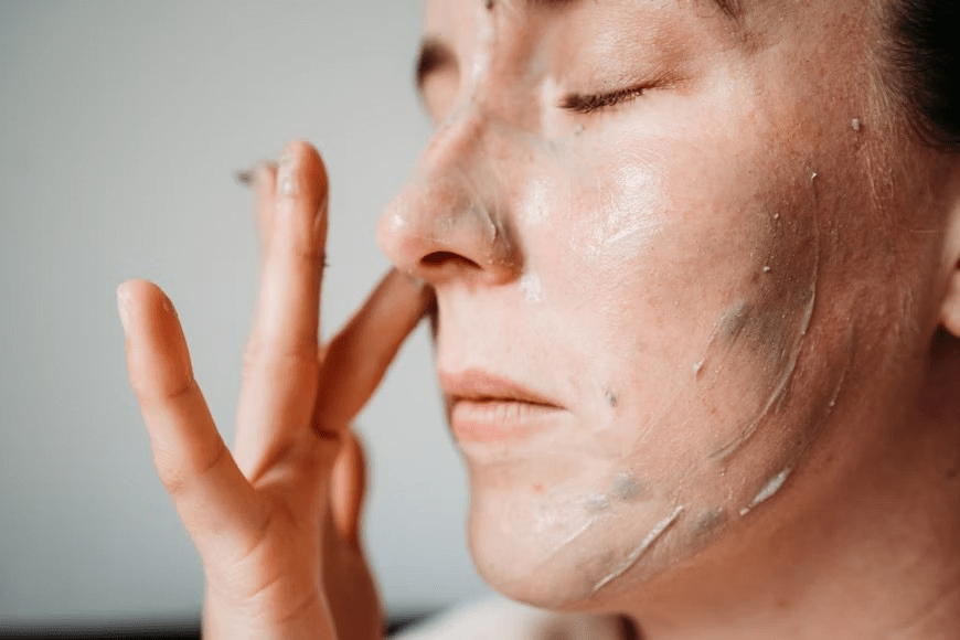 Photo of skin discoloration 